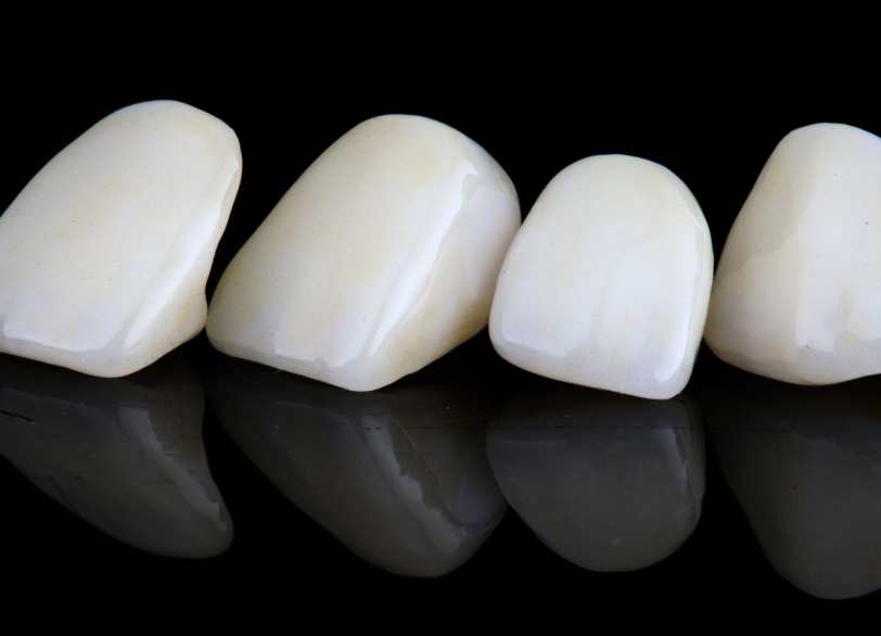 e-max｜芦屋ラポルテ