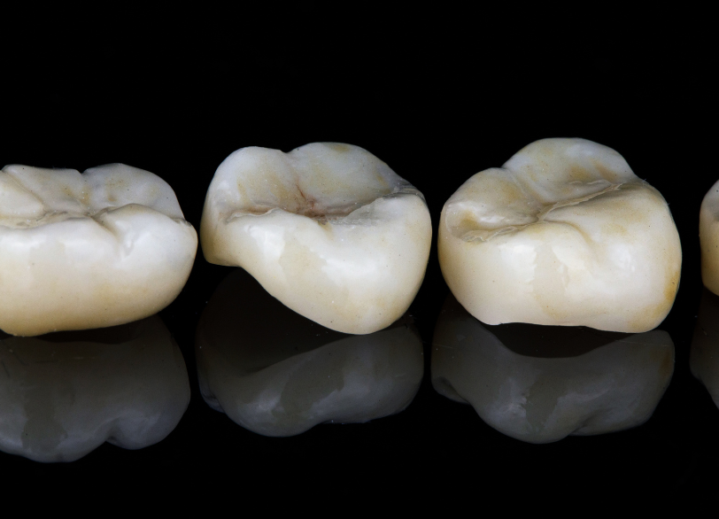 ジルコニア｜芦屋ラポルテ