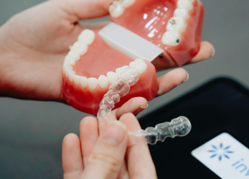 インビザライン｜芦屋ラポルテ