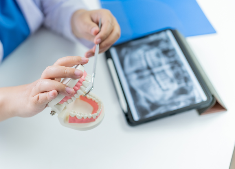 お口の中への影響｜芦屋ラポルテ