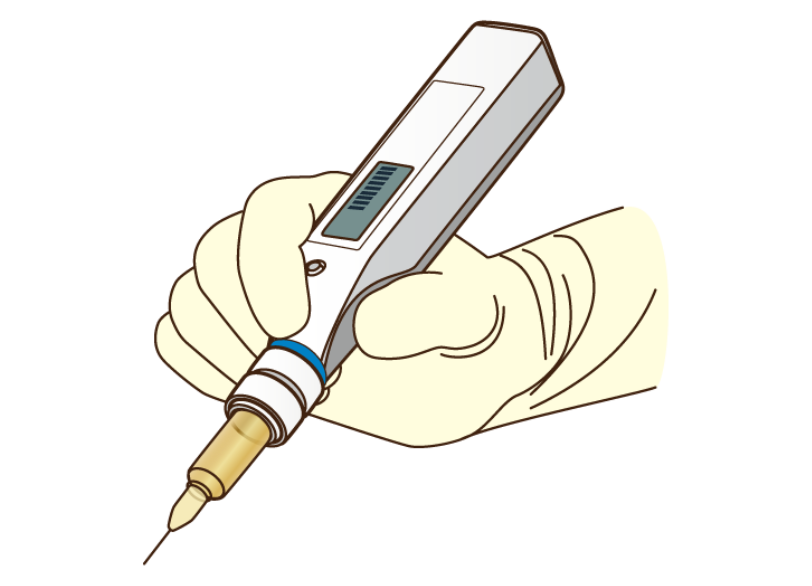 電動麻酔注射｜芦屋ラポルテ