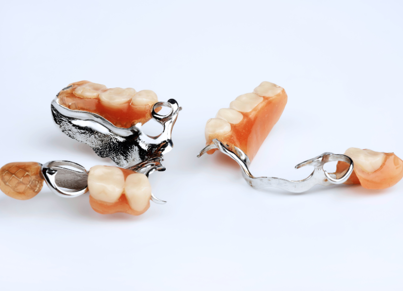 部分入れ歯｜芦屋ラポルテ