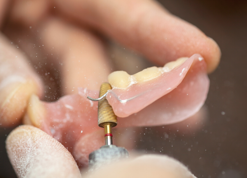 歯科技工士との連携｜芦屋ラポルテ