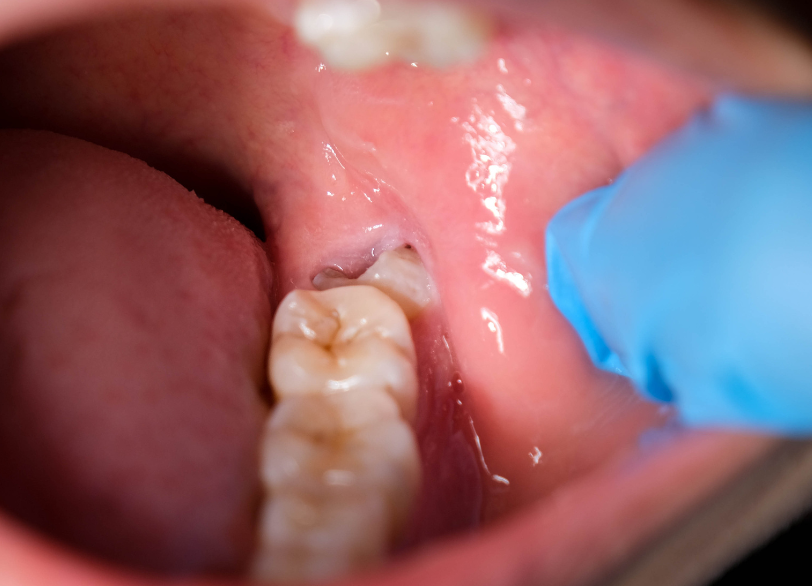 清掃不良｜芦屋ラポルテ