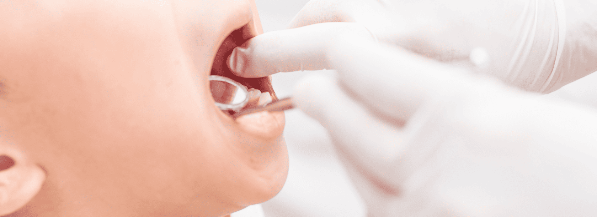 私たちは無理やり治療することはありません｜芦屋ラポルテ