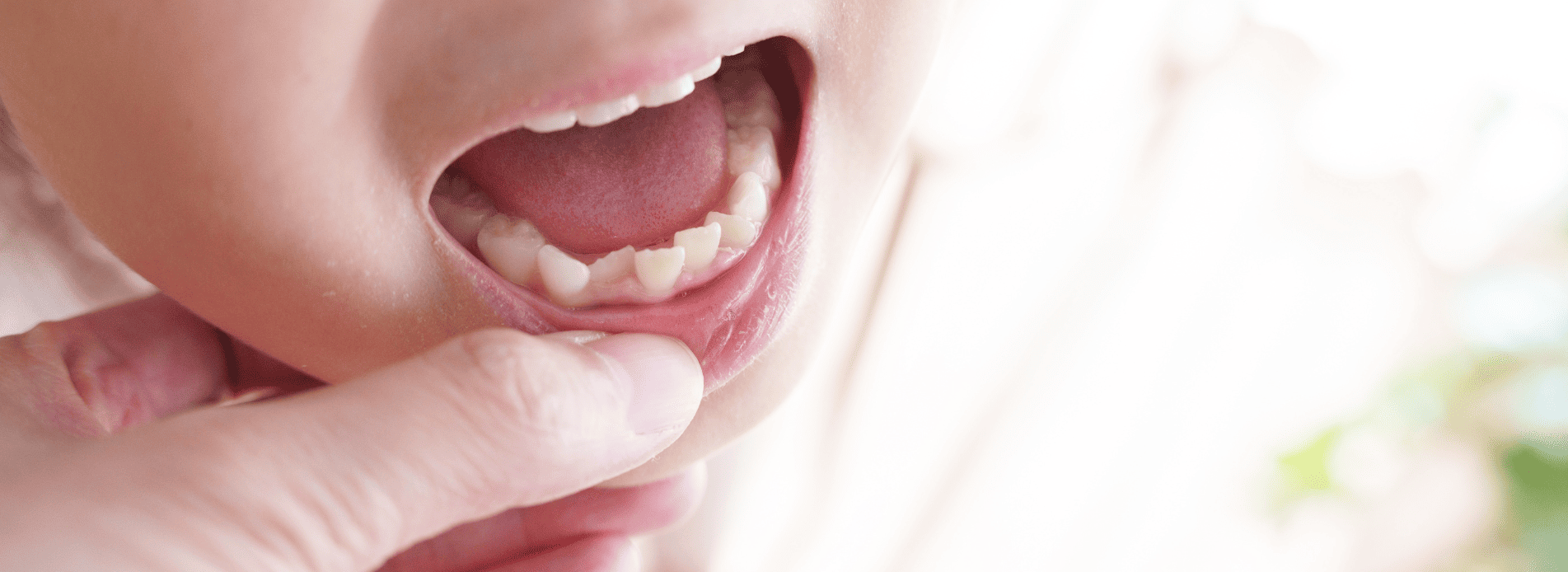 小児矯正はいつから始める｜芦屋ラポルテ