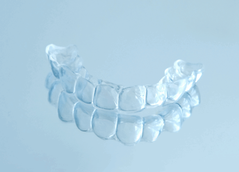 インビザラインファースト｜芦屋ラポルテ