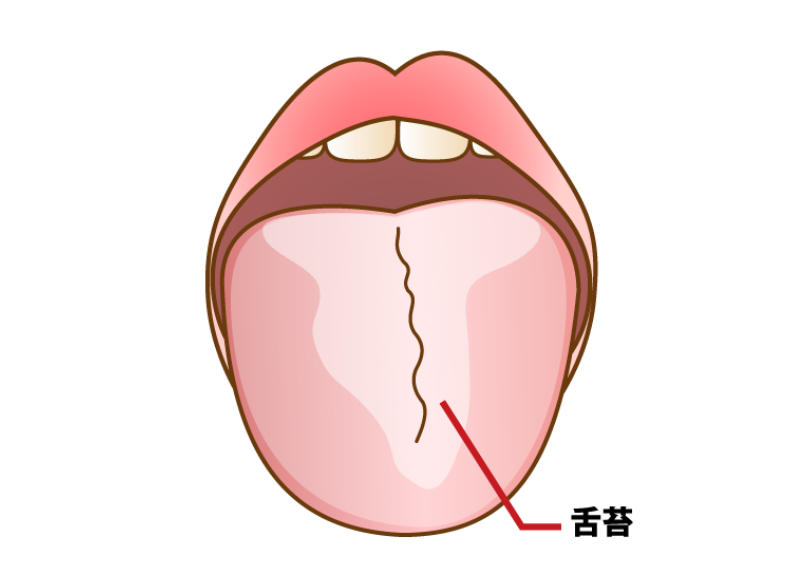 舌苔｜芦屋ラポルテ