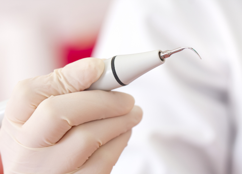 スケーリング｜芦屋ラポルテ