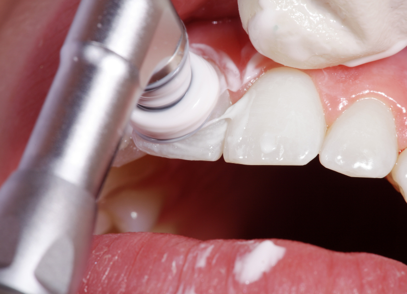 PMTCとは｜芦屋ラポルテ