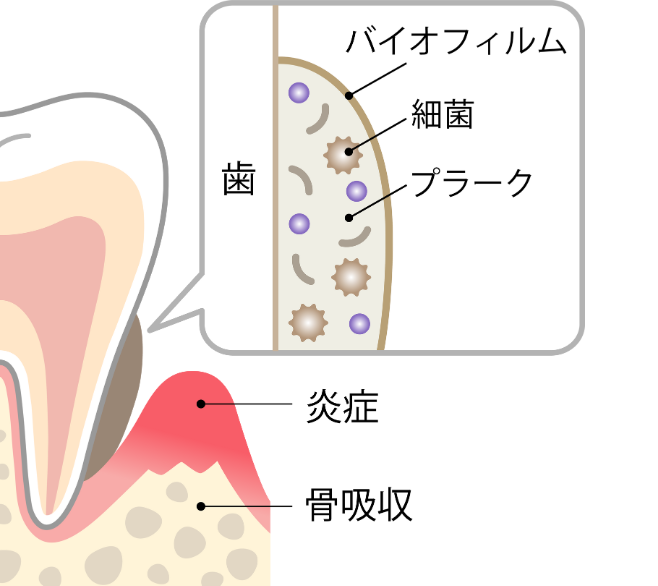 バイオフィルム｜芦屋ラポルテ