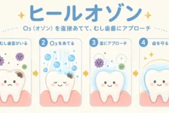 保護中: ヒールオゾン治療